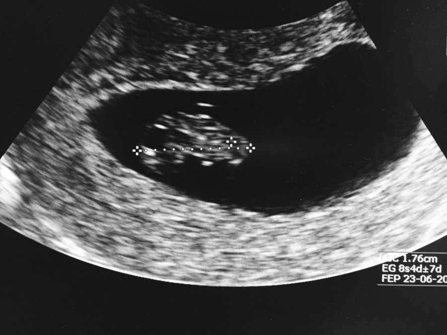 El primer eco… la cédula de tu&nbsp;bebé!